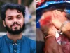 ঢাকা-৮ আসনের প্রার্থী হাদি গুলিবিদ্ধ: কানের নিচে গুলি লেগেছে,অবস্থা আশঙ্কাজনক ঢাকা-৮ আসনের প্রার্থী হাদি গুলিবিদ্ধ