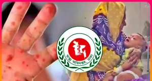 হামে মৃত্যুমিছিল: ২৪ ঘণ্টায় আরও ১২ শিশুর প্রাণহানি, মোট মৃত্যু ৪৫১ হামে শিশুর মৃত্যু