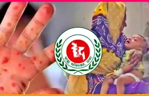 হামে মৃত্যুমিছিল: ২৪ ঘণ্টায় আরও ১২ শিশুর প্রাণহানি, মোট মৃত্যু ৪৫১ হামে শিশুর মৃত্যু
