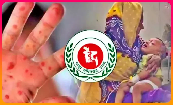 হামে শিশুর মৃত্যু