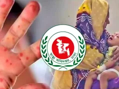 হাম ও উপসর্গে একদিনে রেকর্ড ১৭ জনের মৃত্যু: এক বছরের সর্বোচ্চ হাম আক্রান্ত রোগী ও স্বাস্থ্য সচেতনতা