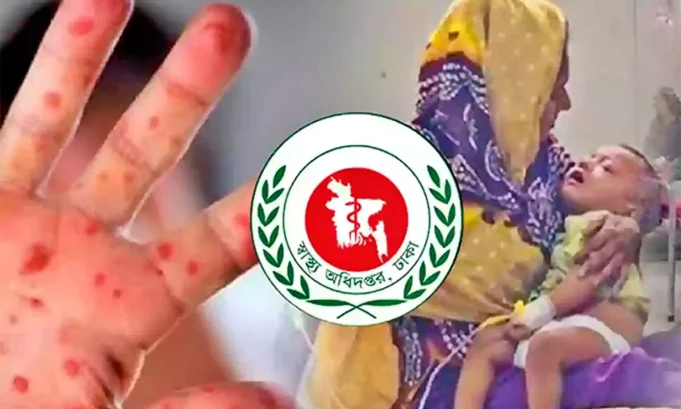 হাম আক্রান্ত রোগী ও স্বাস্থ্য সচেতনতা